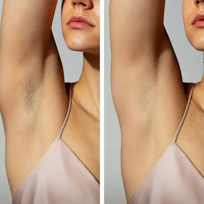 MyPulsea™ IPL Pulse | Épilateur à Lumière Pulsée Haute Performance
