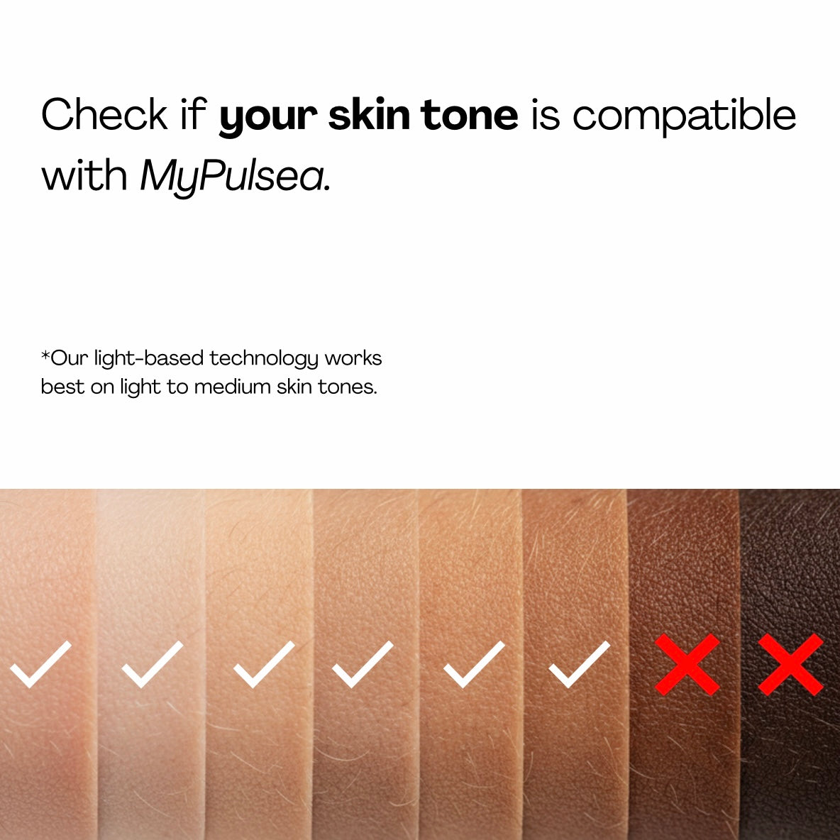 MyPulsea™ IPL Pulse – Professional Smooth Skin at Home