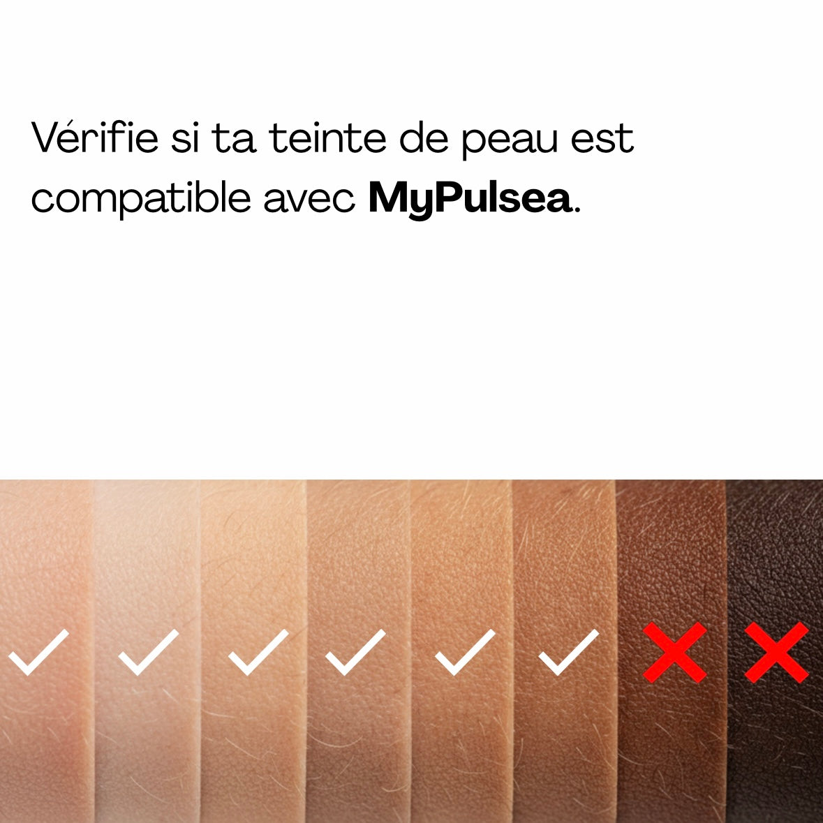 MyPulsea™ IPL Pulse | Épilateur à Lumière Pulsée Haute Performance